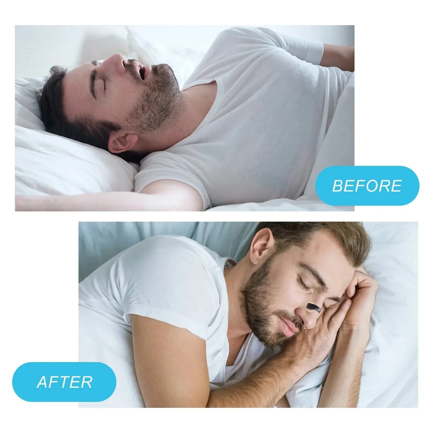 Nasal Dilator