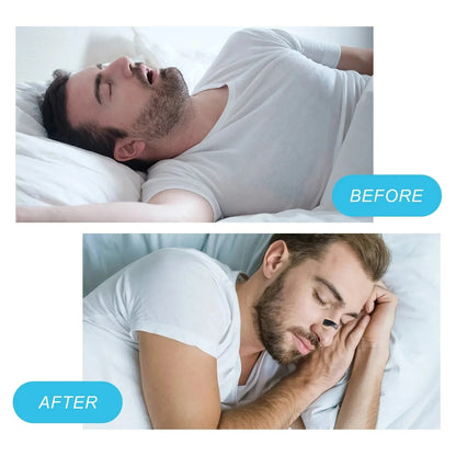 Nasal Dilator